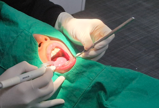 한티역치과, 라미네이트 잘하는 곳 찾기 힘들죠? 의사가 고르는 기준 공개 관련 이미지 5