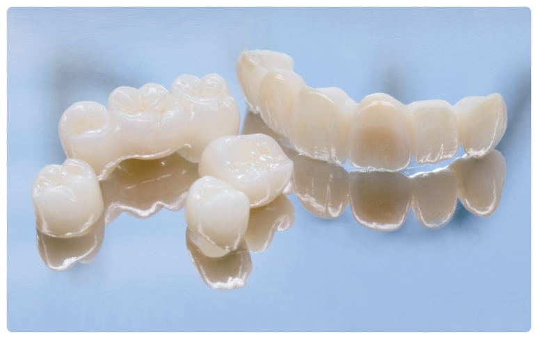 아스트라임플란트? OO부터 확인하세요. 관련 이미지 3