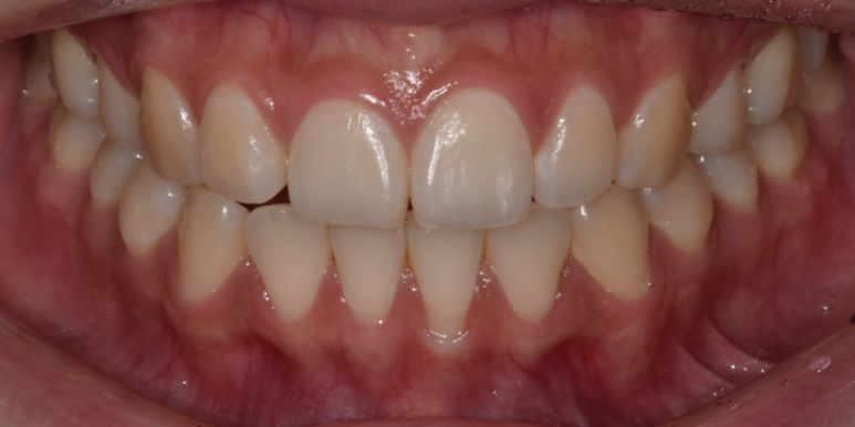 라미네이트색상, 모양 후회 안하려면? 관련 이미지 4