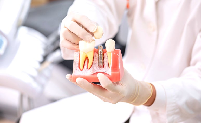 선릉역임플란트, 통증과 비용이 걱정인 분만 보세요. 관련 이미지 4