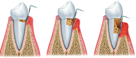 강남 치주잇몸소파술 치과, 손해 보기 싫다면? 관련 이미지 3