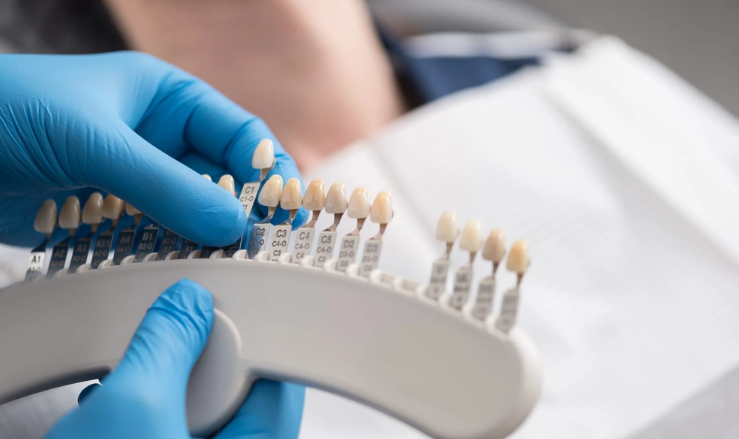 서초동라미네이트, 잘하는 치과특징 3가지 정리했습니다 관련 이미지 5