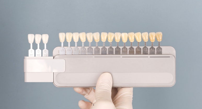 라미네이트색상, 모양 후회 안하려면? 관련 이미지 8