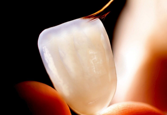 라미네이트 실패원인, 일상생활에서 주의할 2가지 관련 이미지 3