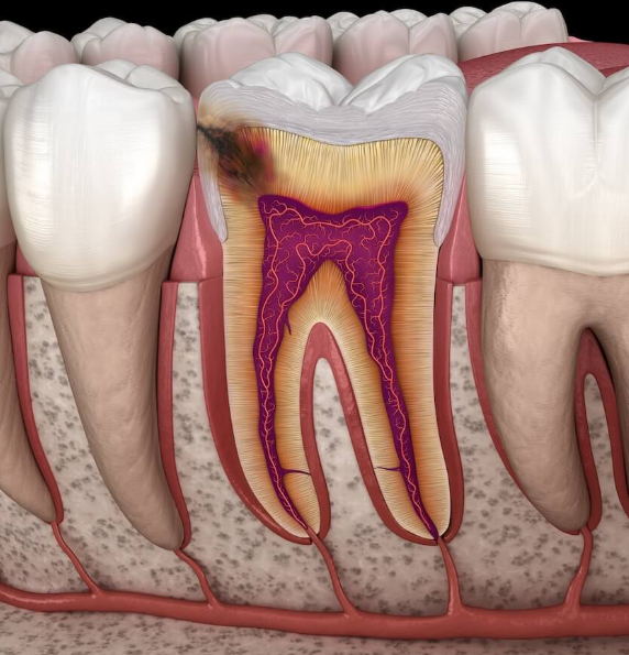 서울 직장인 구강검진, "바쁘다고 미루면" 생기는 변화 관련 이미지 3