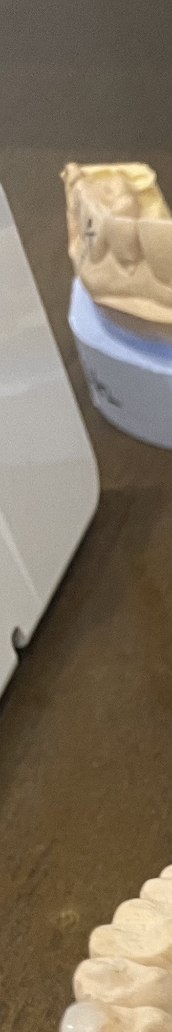 매봉역 치과, 자연치아 잃고 싶지 않다면? 관련 이미지 6