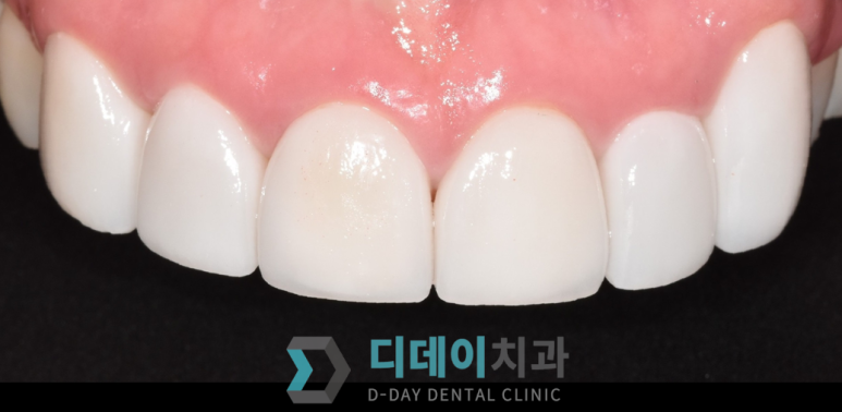 강남구청역/압구정로데오역 치과? 00부터 확인하세요 관련 이미지 2