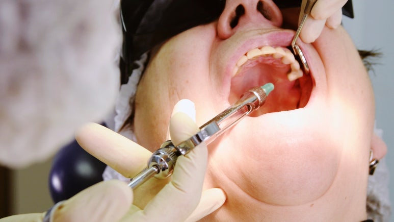 임플란트보증기간? 전문의가 설명드립니다. 관련 이미지 4