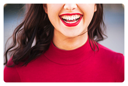 무삭제 라미네이트 비용만 보다가 돈 2배 날리는 환자 특징? 관련 이미지 3