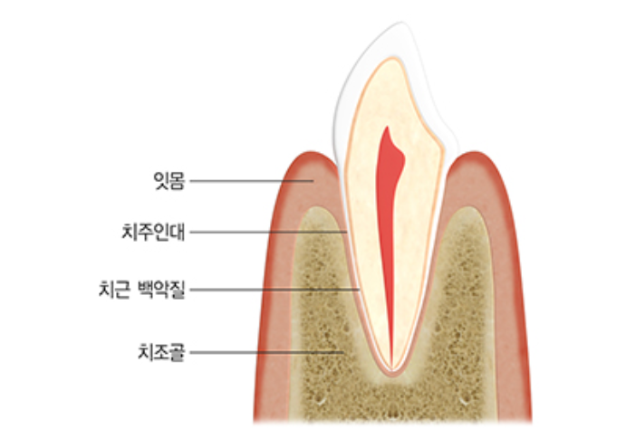 왼쪽어금니통증, 방치하면 안 되는 이유 3가지 관련 이미지 8