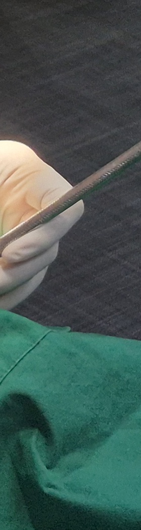 한티역치과 임플란트, 뼈이식 꼭 해야 할까? <의사 답변> 관련 이미지 15