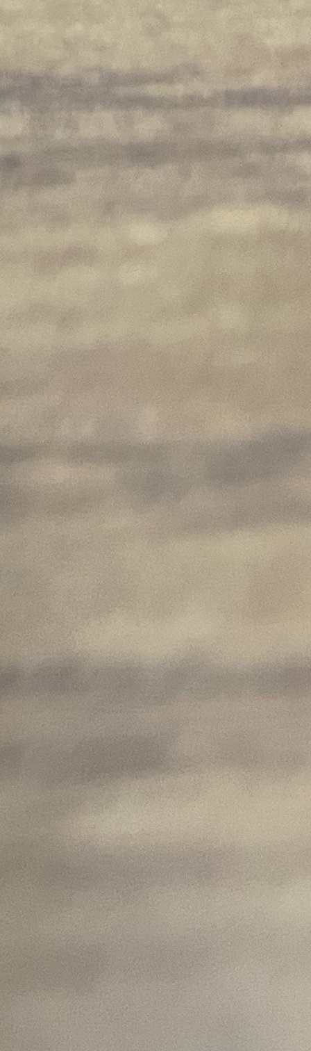 서초동 치과, 통증이 두려워 방문을 꺼리신다면? 관련 이미지 20