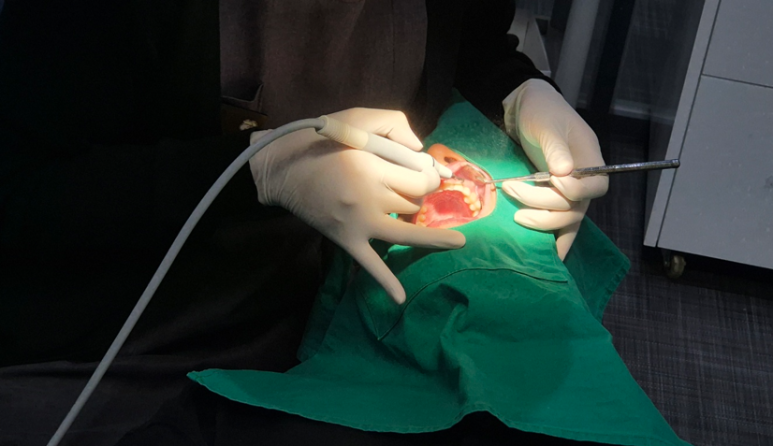 라미네이트 비용, 가격만 보다가 100만원 손해봅니다 관련 이미지 8