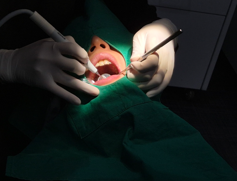 치주염치료비용보다 관련 이미지 7