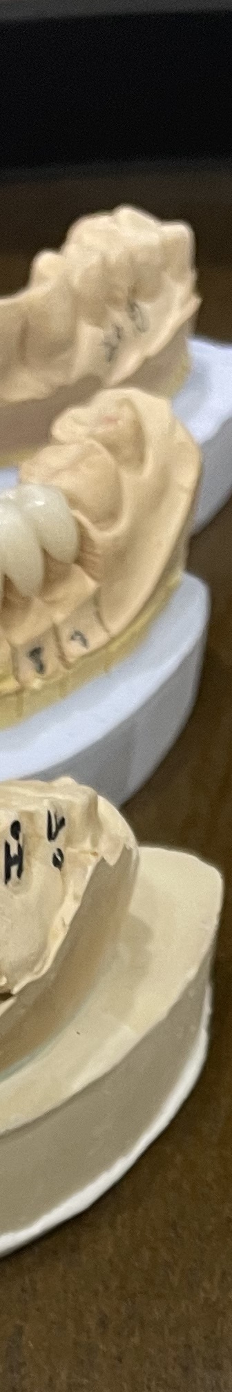 매봉역 치과, 자연치아 잃고 싶지 않다면? 관련 이미지 11