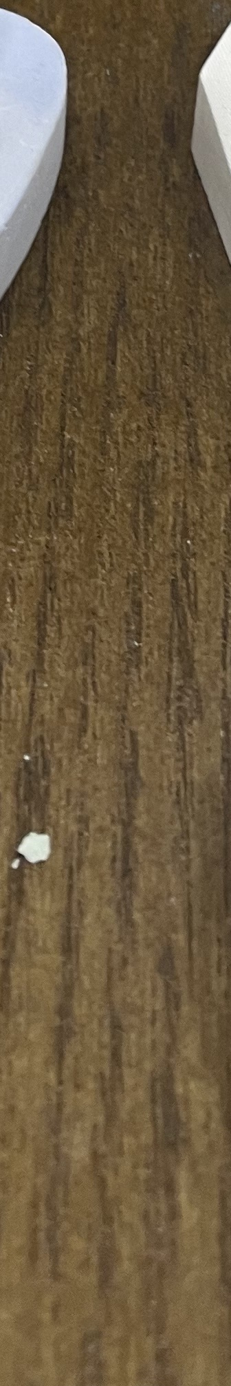 매봉역 치과, 자연치아 잃고 싶지 않다면? 관련 이미지 20