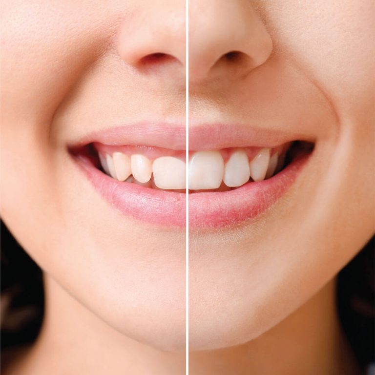 잇몸성형, 환자를 돌려보내는 치과가 있다? 관련 이미지 5