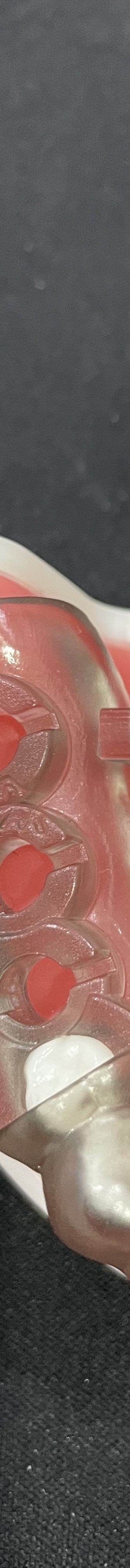 강남역 치과 임플란트 수면마취?해야만 하는 경우 관련 이미지 9