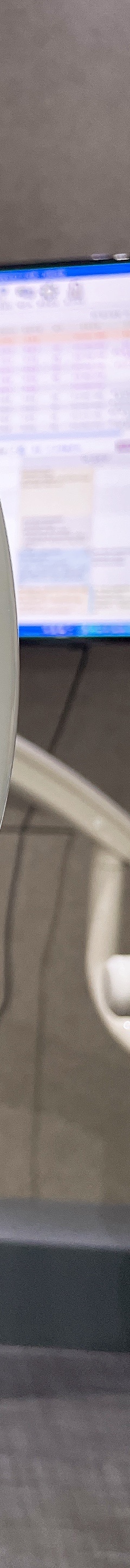 원데이 치과미백 치료? 5000건 해보고 알려드립니다. 관련 이미지 15