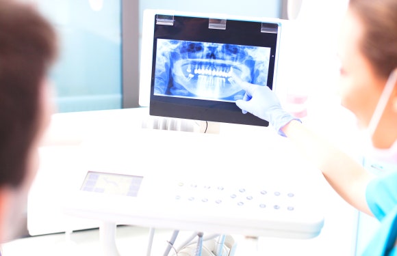 50대 임플란트, 치과의사가 경고하는 이유? 관련 이미지 5