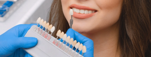 라미네이트 후회하시는 분들 공통점 3가지 관련 이미지 3