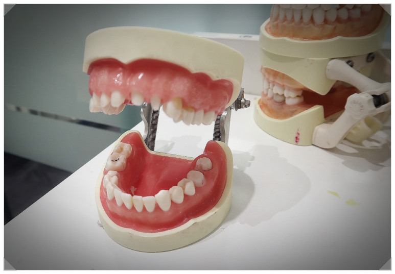 삼성중앙역치과? 전문의 밝히는 진실 관련 이미지 4