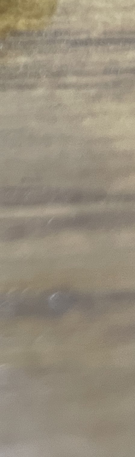 서초동 치과, 통증이 두려워 방문을 꺼리신다면? 관련 이미지 19