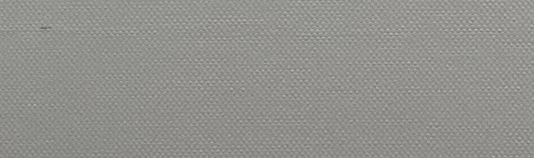 치아미백 vs 라미네이트, 누렁니 탈출하고 싶으신 분들만 관련 이미지 22