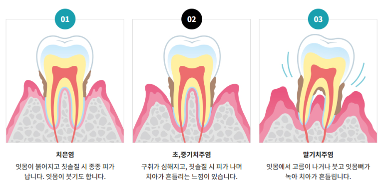 강남설연휴치과, 대체휴일 진료하는 곳 찾으려면? 관련 이미지 3