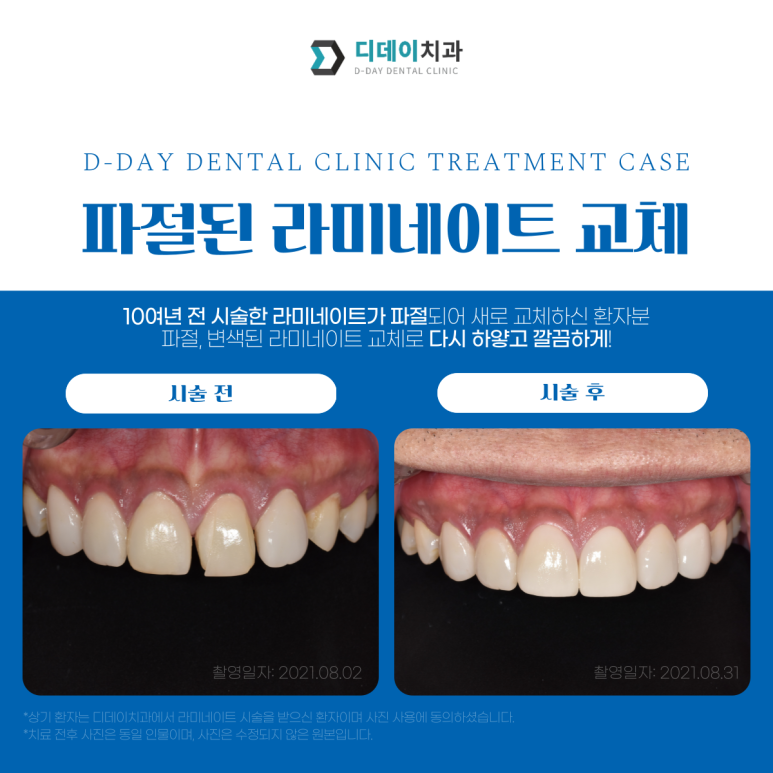 라미네이트as? 후회없는 선택을 위해 꼭 알아두어야 할 것은? 관련 이미지 4