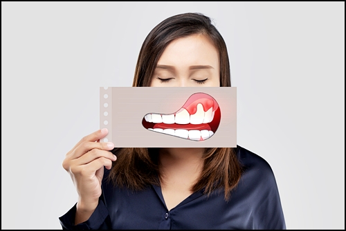 치아사이레진, 재시술을 받지 않으려면 관련 이미지 3