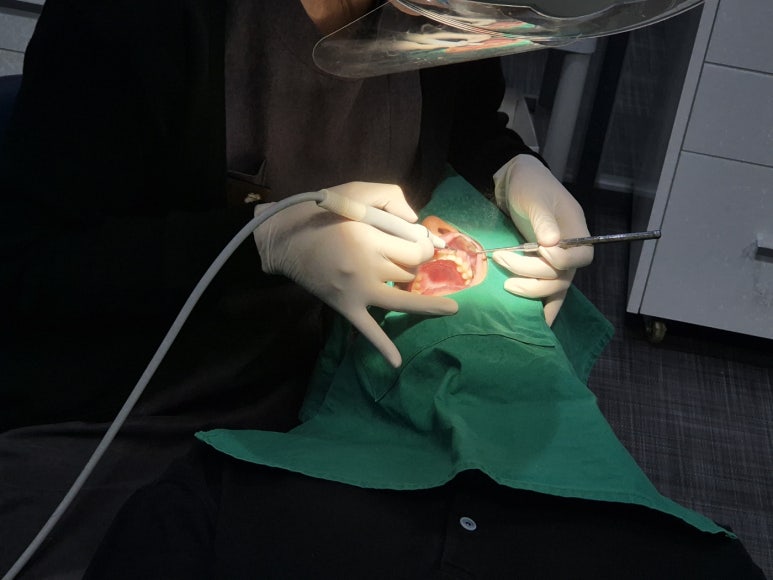 개포동치과, 충치치료 아픈가요? A to Z 알려드립니다 관련 이미지 3