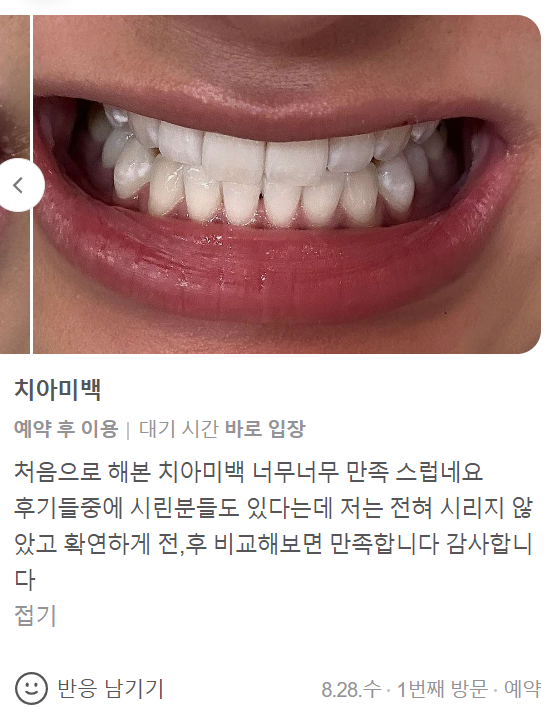 최소증상 치아미백 치과 후기,일본에서도 오는 이유? 관련 이미지 3