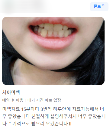 치아미백 vs 라미네이트, 누렁니 탈출하고 싶으신 분들만 관련 이미지 7
