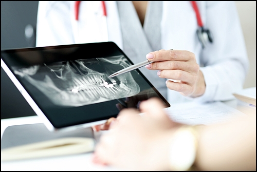 앞니 임플란트 임시치아, 수술 전 꼭 알아야 하는 관련 이미지 3