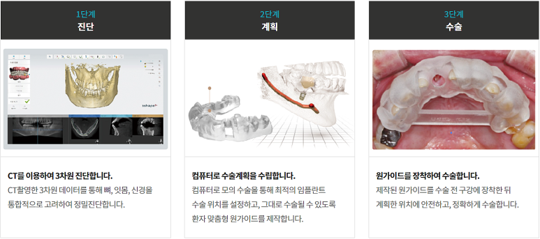 앞이빨임플란트, 내 치아처럼 감쪽같으려면? 관련 이미지 7