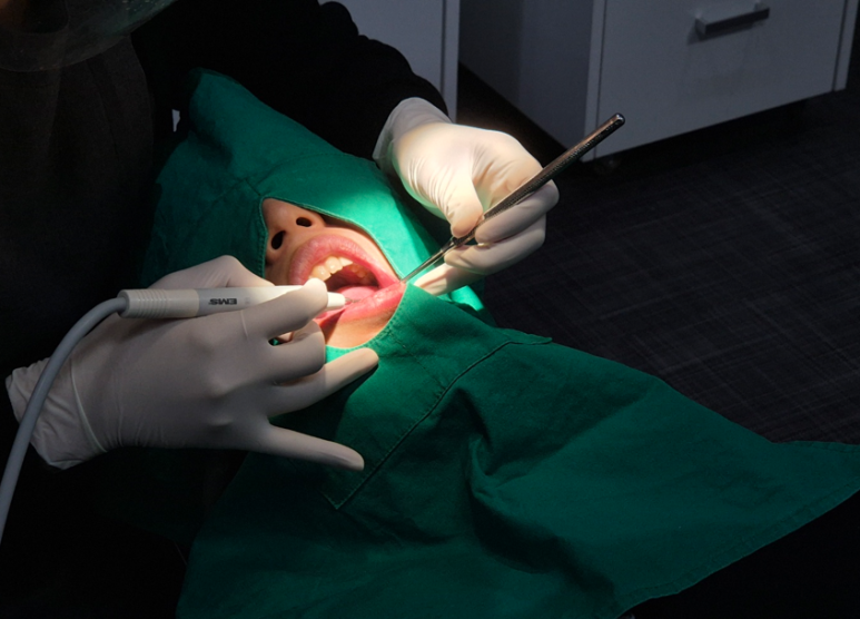 치아쪼개짐, 바로 치과 안가면 신경치료까지 갑니다 관련 이미지 5