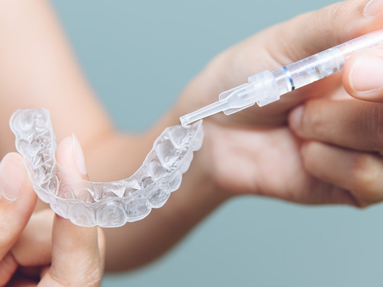 치아미백유지기간부터 종류, 주의사항까지 알려드립니다 관련 이미지 12