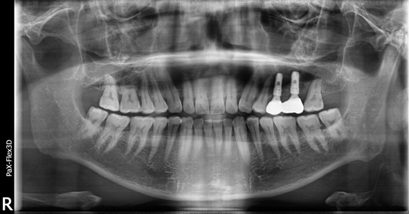 강남치과추천? 내게 꼭 맞는 치과 고르는 방법 관련 이미지 6