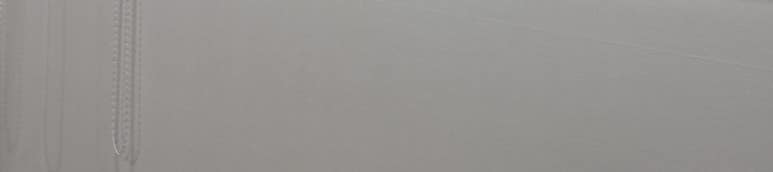 역삼역 치과 가격, 비싸다고 무조건 잘하는 건 아닙니다 관련 이미지 18