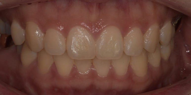 라미네이트과정, 어떻게 진행되는지 궁금하다면? 관련 이미지 4