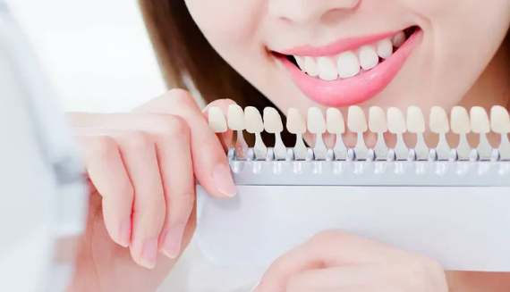 라미네이트 시술 전, 알아야할 3가지 꿀팁 관련 이미지 3