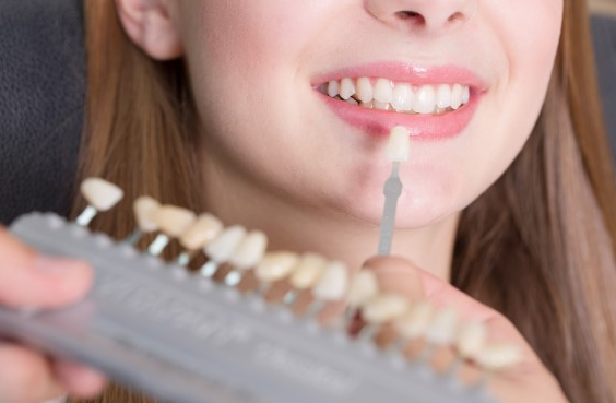 무삭제 라미네이트, 장점과 단점 전문의가 설명드립니다. 관련 이미지 7