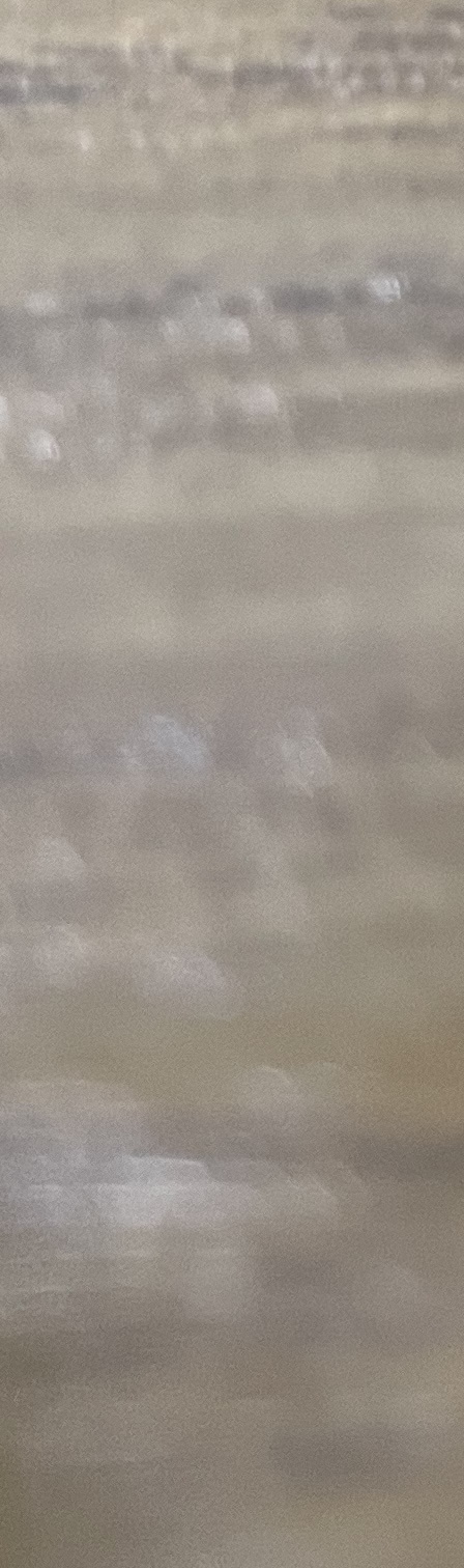 서초동 치과, 통증이 두려워 방문을 꺼리신다면? 관련 이미지 14