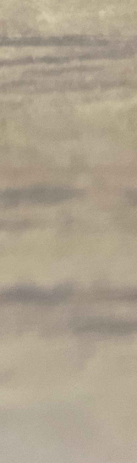 서초동 치과, 통증이 두려워 방문을 꺼리신다면? 관련 이미지 21