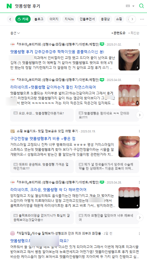 잇몸성형후기, 광고에 속지 않는 방법 관련 이미지 2