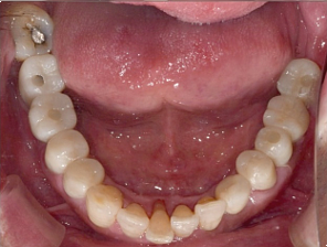 역삼역 치과, 내게 꼭 맞는 치료를 위한 선택법 관련 이미지 8