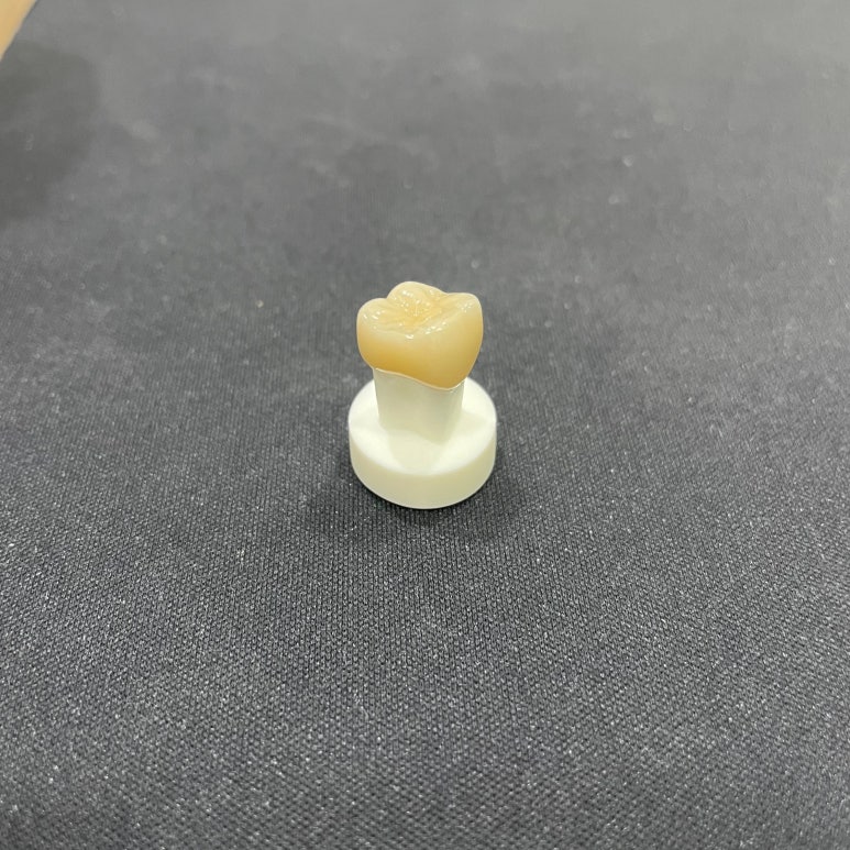 지르코니아크라운 가격만 보고 치과 선택하지 마세요 관련 이미지 3