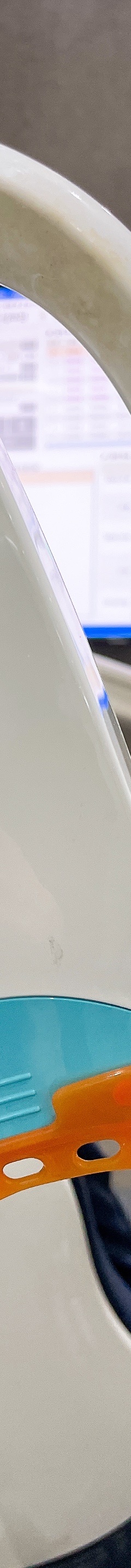 원데이 치과미백 치료? 5000건 해보고 알려드립니다. 관련 이미지 13