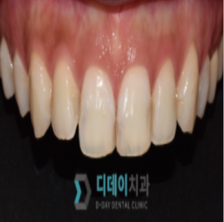 매봉역치과? "양심 치과" 찾는 법 공개합니다. 관련 이미지 1